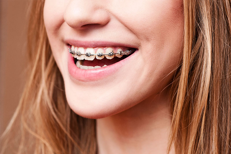 Orthodontics in Honolulu